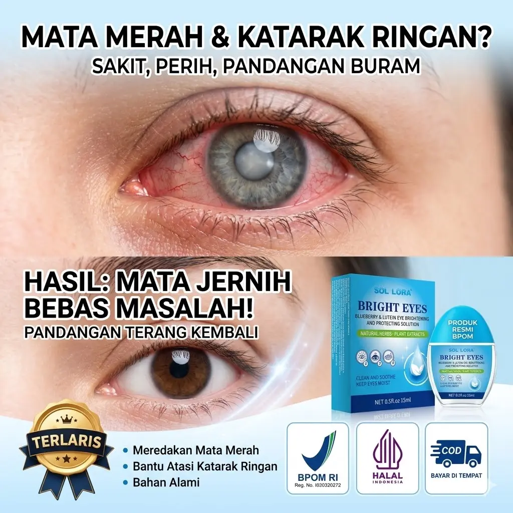 SOL LORA Bright Eyes Tetes Mata Blueberry & Lutein BPOM - Vitamin Mata Ramah Lansia Mengatasi Mata Lelah & Kabur - Herbal Alami Original [COD]