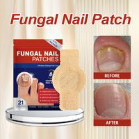 Gambar Obat Jamur Kuku Obat Cantengan Obat Kuku Rusak Pembersih Kuku Kaki Hitam Fungal Nail Treatment Fungal Nail Patches - 21 tablet per kotak dari KRVELLA Kab. Bogor 1 Tokopedia