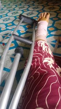 Product Review of Tongkat Ketiak Dewasa / Alat Bantu Jalan Dewasa (Egrang / Krek Ketiak / Kruk Ketiak / Kruk Crutch) from f**i 0