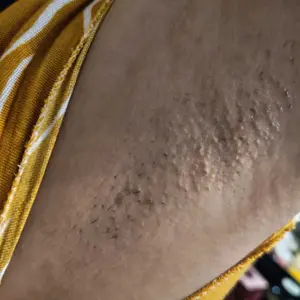 Honnete Intense Glow Underarm Gel 40g - Gel Pencerah Ketiak 5% Niacinamide Anti Bau Badan Dermatologically Tested - 1IG