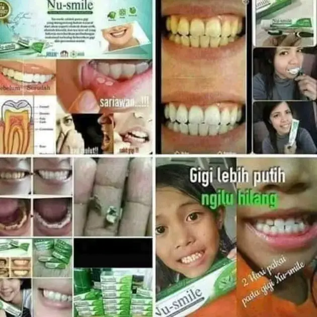 Nu Smile HWI Odol Herbal Rontokan Karang Gigi Perawatan Mulut 5