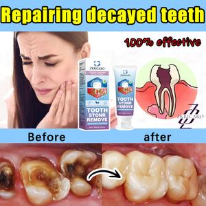 Ubat Gigi 4-dalam-1, Penyingkiran Karang Gigi Berkesan, Rawatan Caries Pergigian, Pemutihan Gigi, Penghilang Nafas Berbau!