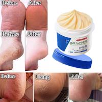 Gambar cream kaki pecah dan kering krim kaki foot cream krim kaki obat kaki pecah pecah tumit kaki pecah dan kering - 1 PCS dari ZOLVYN Kab. Bogor 3 Tokopedia