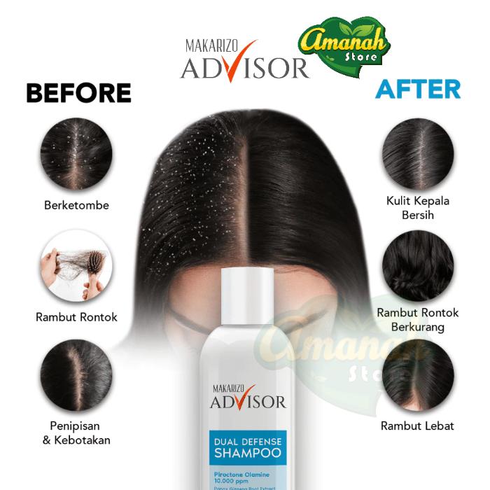 Makarizo Advisor CLINICAL SHAMPOO - Dual Defense Shampoo 200 mL 2