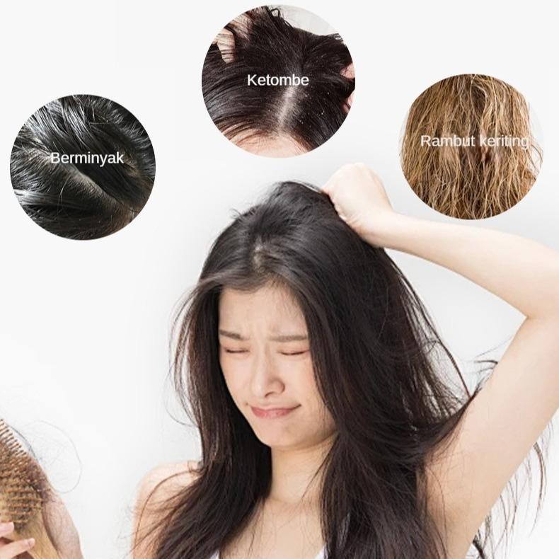 Shampoo Uban Menjadi Hitam 300ML / Shampoo Uban Permanen Black Herbal Natural Polygonum Multiflorum Hair Blackening 5