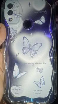 Product Review of Casing hp RedmiNote7/Note7PRO/Note7S  Kupu-kupu lucu transparan gelombang soft shell wanita mewah ringan kelas atas all-inclusive anti-fall case from A**t 2