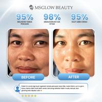 Gambar MS GLOW Ultimate Paket Skincare Flek Hitam Noda Bekas Jerawat Anti Aging Hiperpigmentasi Penuaan Dini Mencerahkan Wajah Kusam Memudarkan Kerutan - PKT ULTI+ELIXIR NEW dari Biliva Beauty Store Kota Surabaya 4 Tokopedia
