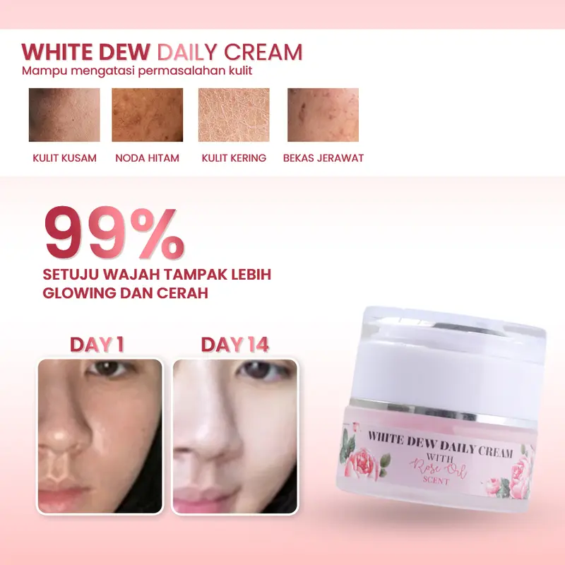 HB Haibuna  White DEW SET + Serum (5pcs) | Whitening Set - Niacinamide Tranexamic | Perawatan Membantu Mencerahkan dan menyamarkan FLEK Hitam | skincare Aman bumil busui | Extract Rose Oil 3
