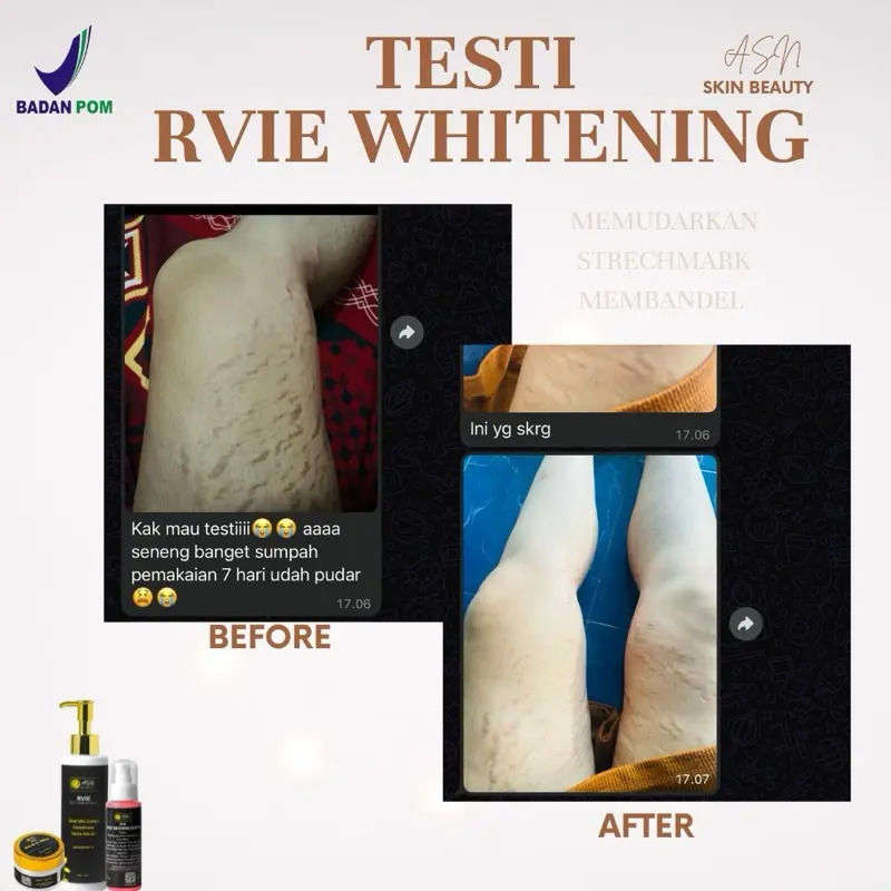 Bundling Bodycare Rvie Whitening Pencerah 5
