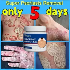 South Moon Eczema Skin Repair Cream Relieves Redness Nourishing Repair Skin