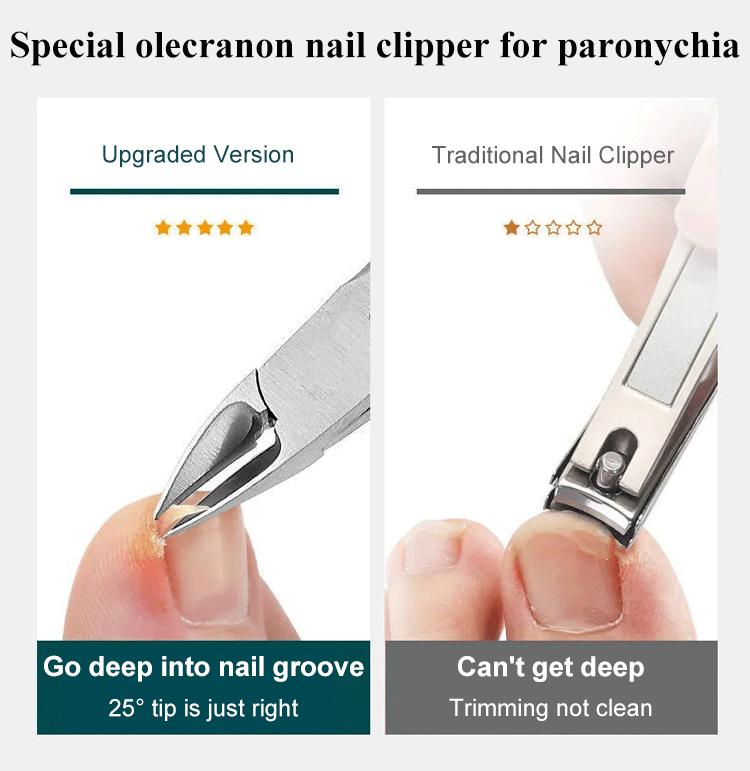 Product Introduction of Nail clippers for ingrown toenails single hawkbill clippers for gray fingernails nail fissures 2