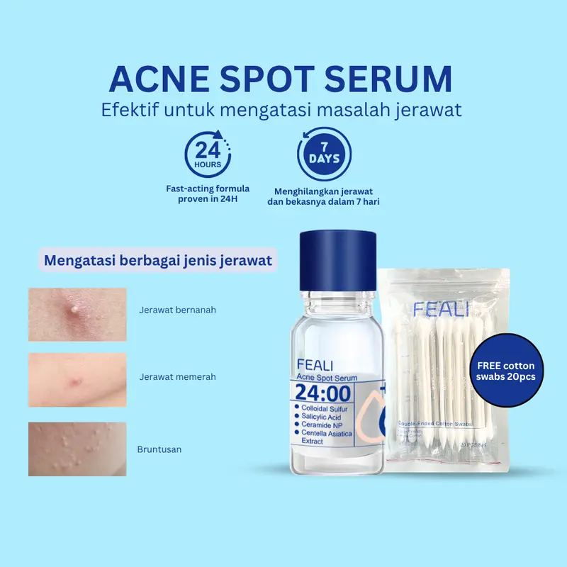 [YUXI] FEALI Acne Spot Serum 10ml - Serum Untuk Mengurangi Dan Memperbaiki Kulit Berjerawat FREE Cotton Swabs 20pcs - Perawatan Wajah 5