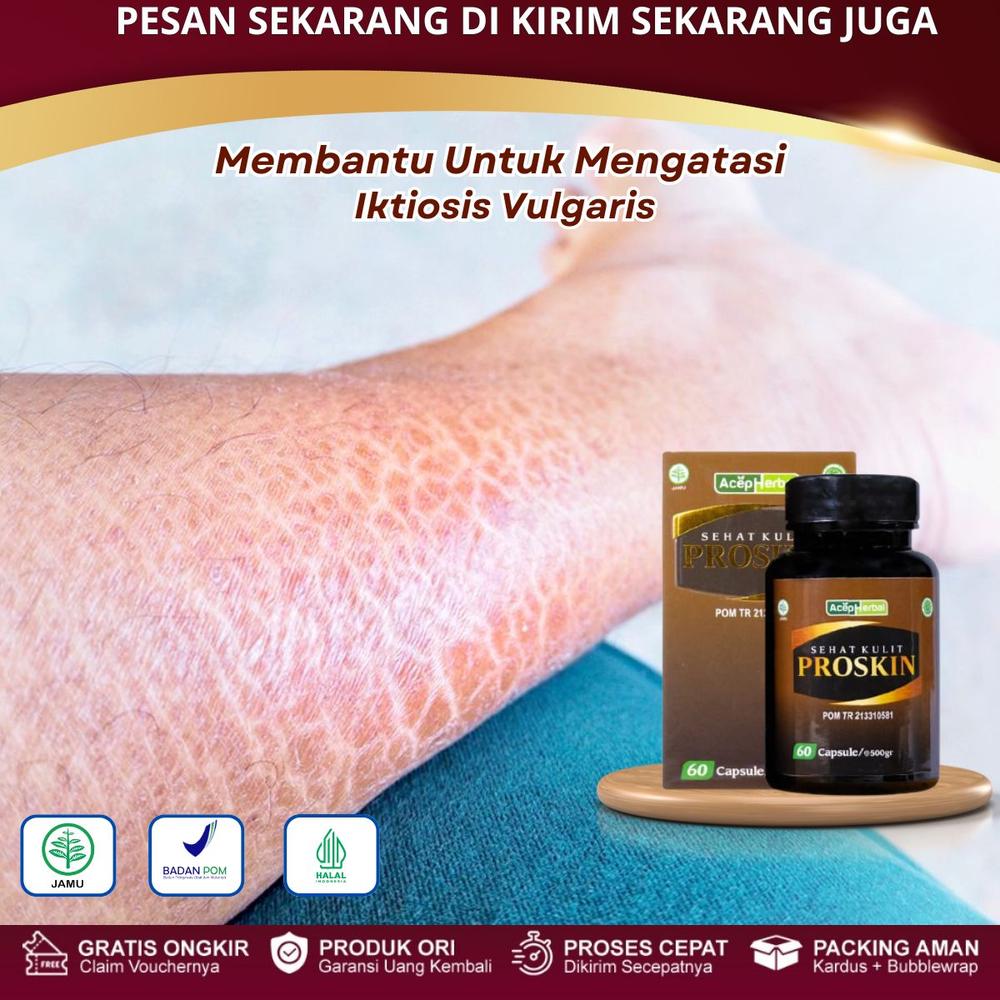 Proskin - Untuk Kulit Iktiosis, Vulgaris Infeksi, Penebalan Kulit Kering, Penghilang Gatal Bersisik, Seboroik, Dermatitis