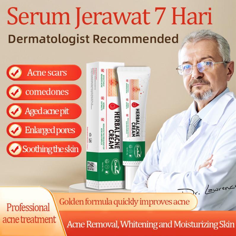 （T1）BPOM.Beli 2 Gratis 1.Challenge 7 Hari Jerawat Hilang,CINSULIN Obat Jerawat Herbal Ekstrak Alami Cepat Hilangkan Komedo & Jerawat Meradang  BPOM Certified  Aman untuk Remaja & Kulit Sensitif Berjerawat Wajah Gatal Beruntusan 1