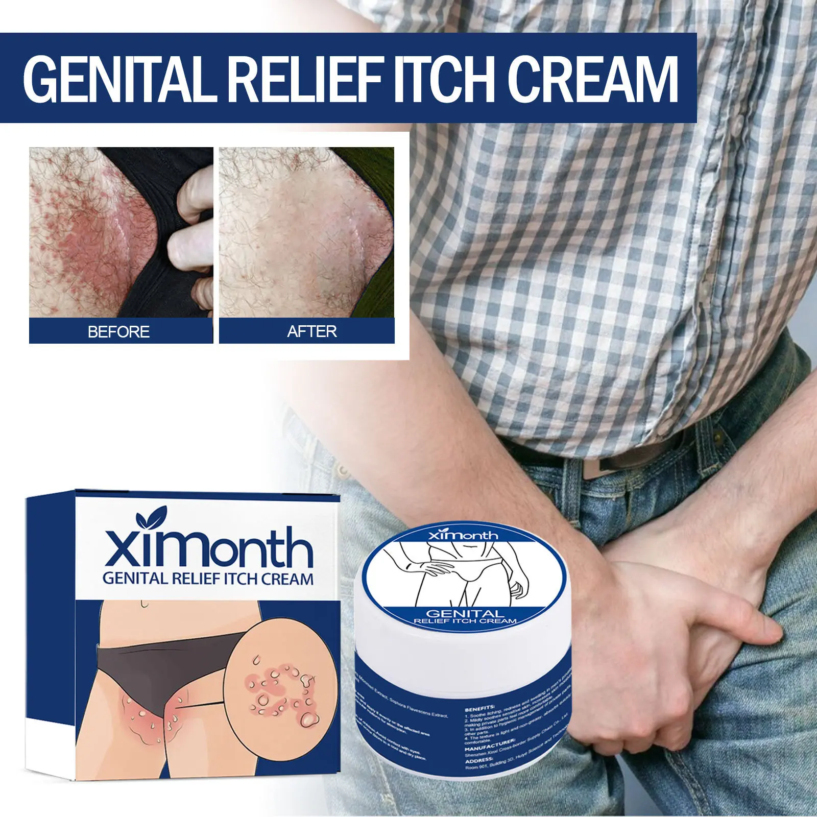 Skin Itch Relief Cream – 10G Soothing Formula for Redness, Itching, and Skin Moss Repair, 3-Year Shelf Life