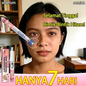 Pena Laser Penghilang Bintik Hitam, Memudarkan Bintik, Menghilangkan Melasma, Memutihkan Kulit, Efektif, Nirkabel untuk Penggunaan di Rumah