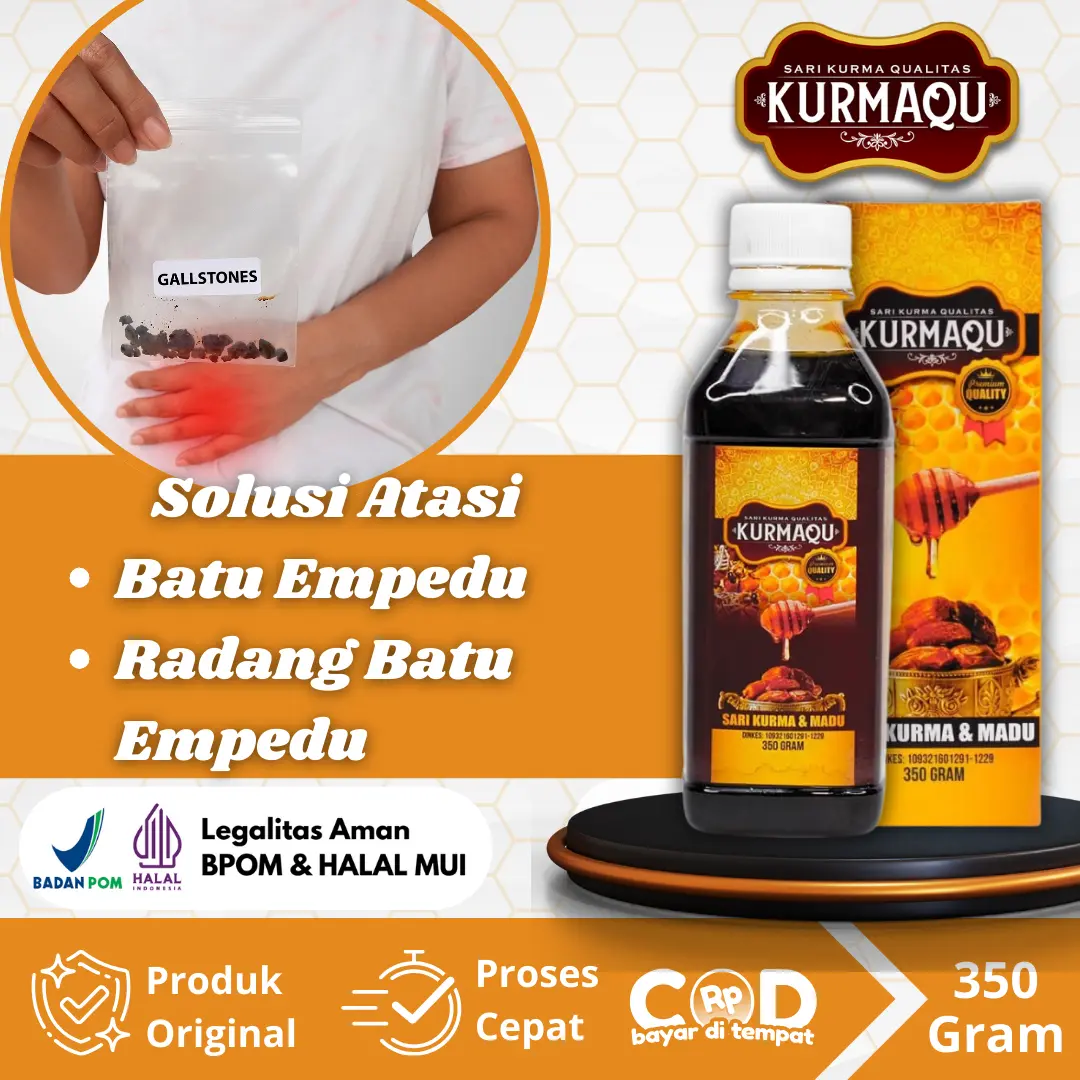 Untuk Batu Empedu, Penghancur Batu Empedu, Saluran Empedu Tersumbat Dengan Kurmaqu - 350