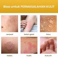 Gambar Salep Kulit Kuning 7 gram – Membantu Meringankan Penyakit Kulit dari Kembang Bulan Indonesia Kota Surabaya 3 Tokopedia