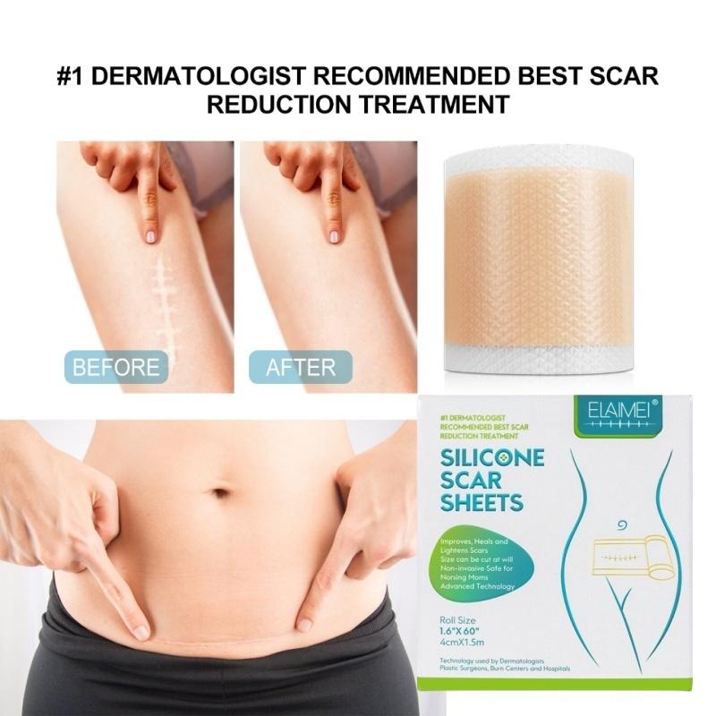 ⭐️ORI⭐️ELAIMEI Silicone Scar Sheets Patch Penghilang Keloid Tambalan Stretch Mark Surgery Scar Removal Silicone Repair Tape 4cm x 1.5m - Ready 7