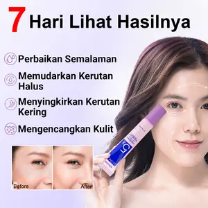 Krim Mata 5x Retinol - Mengangkat Kulit Sekitar Mata + Mengurangi Lingkaran Hitam, Cocok untuk Seluruh Wajah (Menghilangkan Kerutan Halus, Kantung Mata, Lingkaran Hitam). Solusi Cepat untuk Kantung Mata Kendur