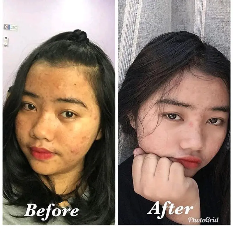 Spirulina Tiens perawatan masker mencerahkan wajah 4