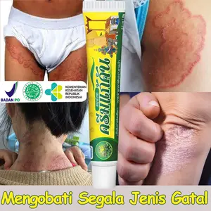 Thailand Salep gatal 20g Obat gatal selangkangan jamur Alergi gatal kulit Psoriasis Kurap Eksim Bau kaki Cocok bayi&wanita hamil