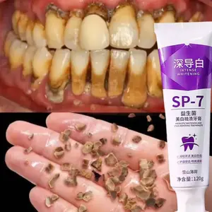 Pasta Gigi Pemutih SP-7 Probiotik 120g Menghilangkan Noda Karang Gigi Segar Aman untuk Siswa Dewasa dan Anak-anak Mencerahkan Gigi dan Membantu Memperbaiki Bau Mulut