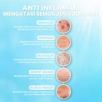 Gambar [BPOM] Oilyoung Triple Active Anti Acne Serum 10g - Salicylic Acid Acne Drying Lotion Serum Jerawat Acne Treatment Wajah Berjerawat Extract - 1 Botol dari Oilyoung Indonesia Kab. Tangerang 4 Tokopedia