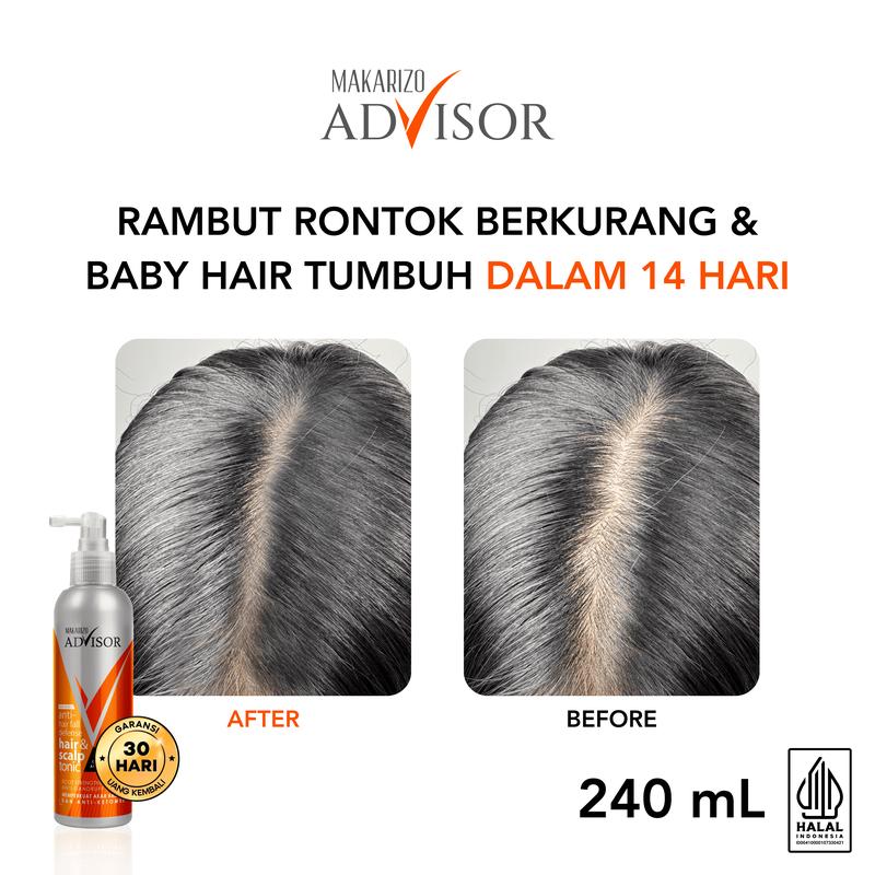 Makarizo Advisor Hair & Scalp Tonic 240mL - 2 in 1 Untuk Rambut Rontok dan Ketombe / Memperkuat Akar Rambut 3