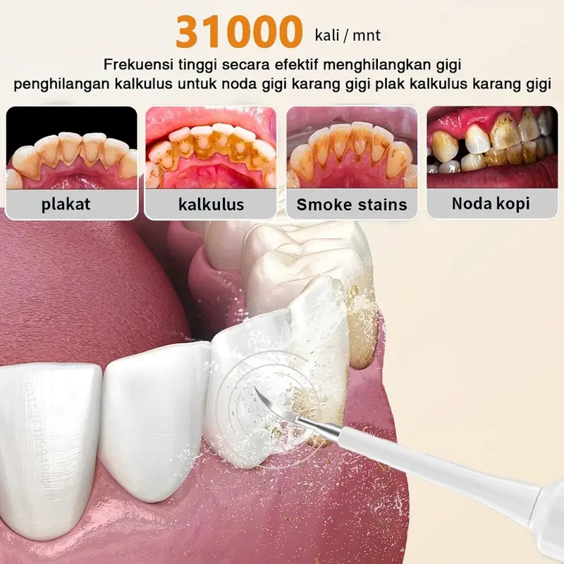 Electric Toothbrush Alat pembersih karang gigi sendiri Cerdas Ultrasonic Scaling Menghilangkan plak karang gigi Pembersih gigi elektrik 2 IN 1 Tool Dental Scaler Ultrasonic Toothbrush Portable / Tartar Remover Tool / Tooth Cleane /Alat Pembersih Plak Gigi 6