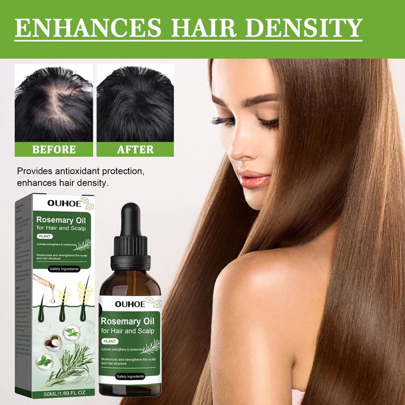 Rosemary hair oil hair tonic penumbuh rambut dengan cepat dan botak tebal serum rambut rontok Hair growth serum Minyak 3