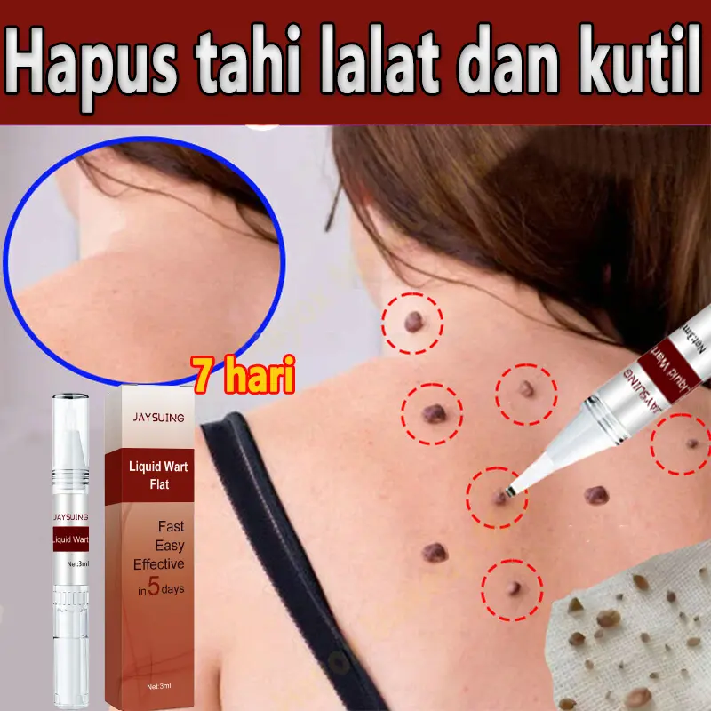 COD Penghilang tai lalat Obat kutil Obat kutil paling ampuh oles Obat penghilang kutil Obat penghilang tahi lalat 3ml Tag recede obat kutil semprot Salep kutil Salep penghilang papiloma Obat penghilanh kutil Jaysuing penghilang kutil Obat tai lalat Kering