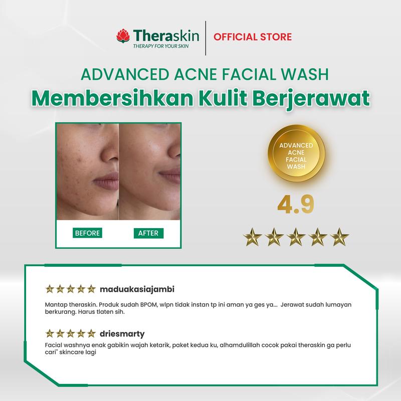Theraskin BPOM Advanced Acne Facial Wash - Sabun Wajah Cair untuk Kulit Berjerawat dan Bruntusan dengan Salicylic Acid dan Allantoin 5