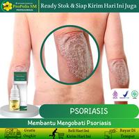 Gambar Propolis SM - Salep Psoriasis, Gatal Eksim, Jamur Eksim di tangan dan kepala Kering dari marsel herbal store Kota Administrasi Jakarta Barat 1 Tokopedia