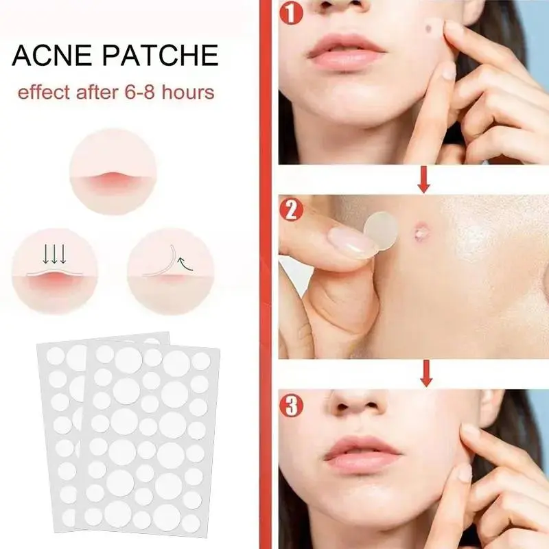 Miếng Dán Mụn Trứng Cá Không Thấm Nước, Focallure, 36 Cái, Điều Trị Mụn Trứng Cá, Chăm Sóc Da, Phục Hồi Mụn Trứng Cá