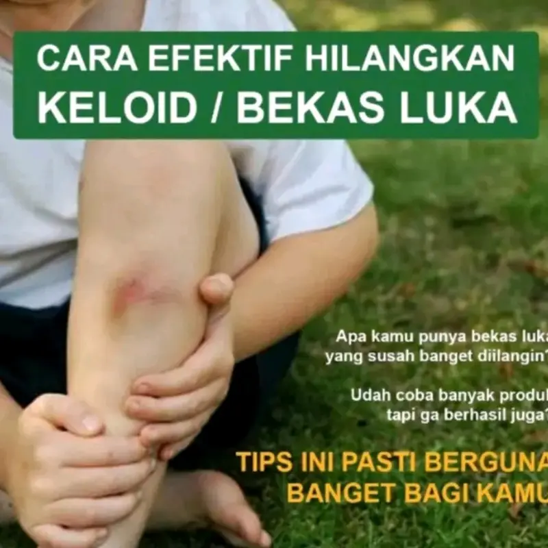 Krim Penghilang Bekas Luka Bio Herbal Meili Beauty Cream 2