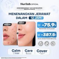 Gambar Nurilab - [Extra Promo New Formula] Jerawat Hilang, Bekas Lenyap! | Serum Concealer & Acne Conclearing Spot Drying Lotion Salicylic Acid 2% - 08 COOL dari Nurilab.id Kota Tangerang 4 Tokopedia