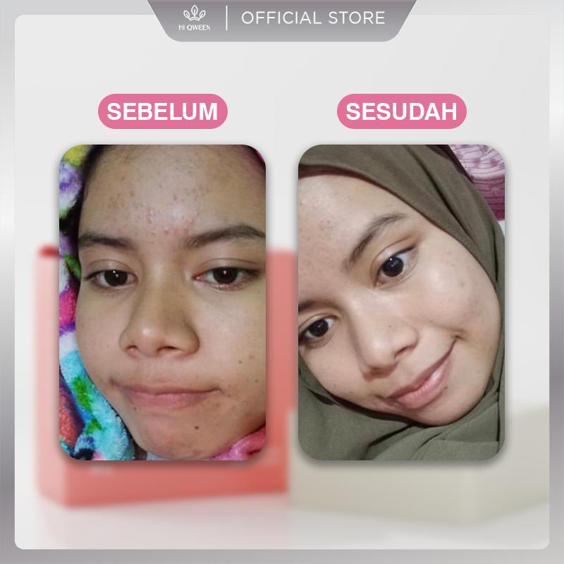 HIQWEEN RETINOL BRIGHTENING SOAP Face Facial Wash Sabun Cuci Muka Badan Retinol Memutihkan Arbutin Kotoran Membersihkan Mencerahkan Wajah Hitam 4