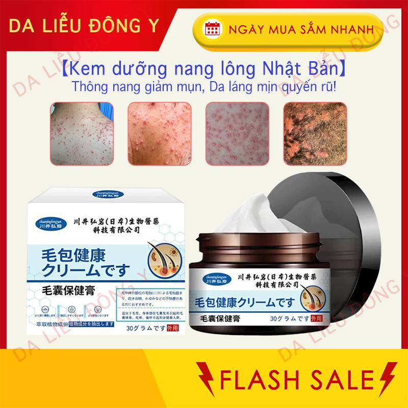  Kem đặc trị viêm nang lông – dùng cho ngứa da đầu nổi mụn mủ sẩn mụn trứng cá trên da đầu trán ngực và lưng. 