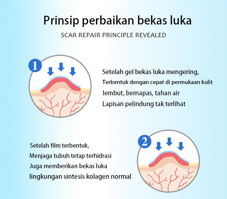 Original Import Cream Penghilang Bekas Luka Krim Ampuh PenghilangJerawat Bekas Cacar Gatal Koreng Gigitan Nyamuk Serangga Luka Air Panas Knalpot Perawatan Penghilang Bekas Luka Stretch Mark Keloid Cream Salep Luka Bakar Lama Jerawat Koreng