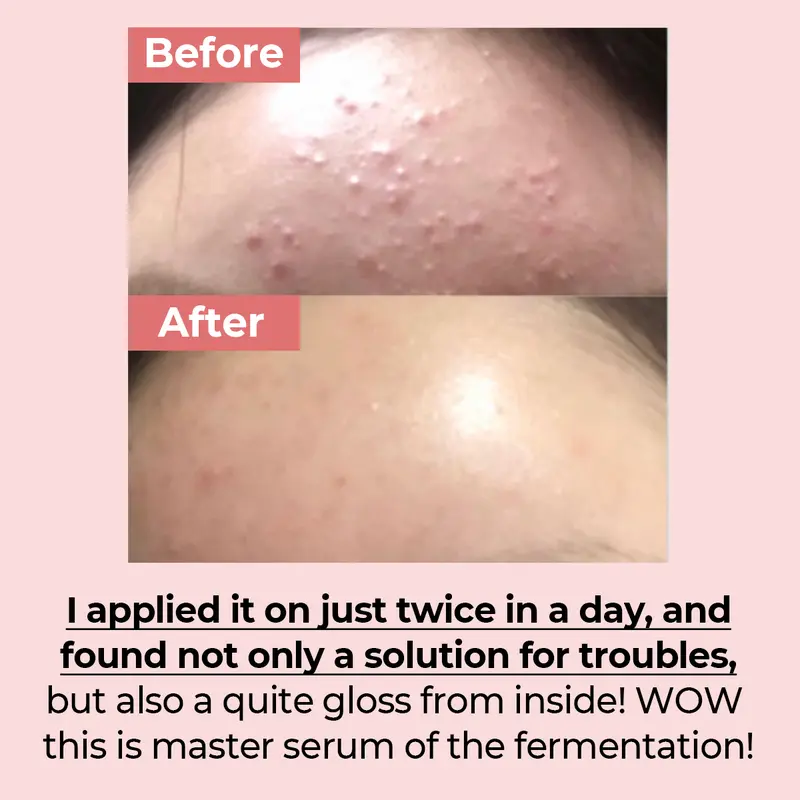 Numbuzin No.3 Skin Softening Serum 50ml 5