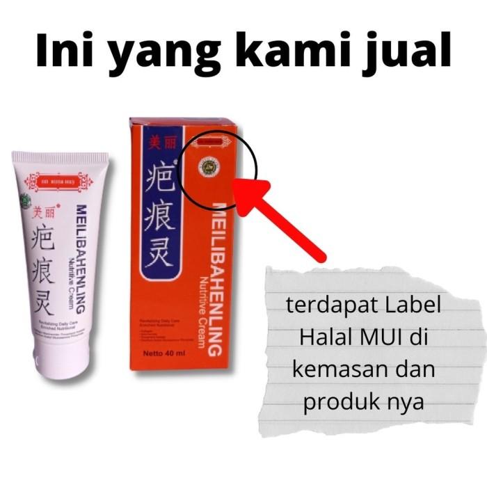 POPULER Promo penghilang bekas luka hitam koreng di kaki lama salep 2