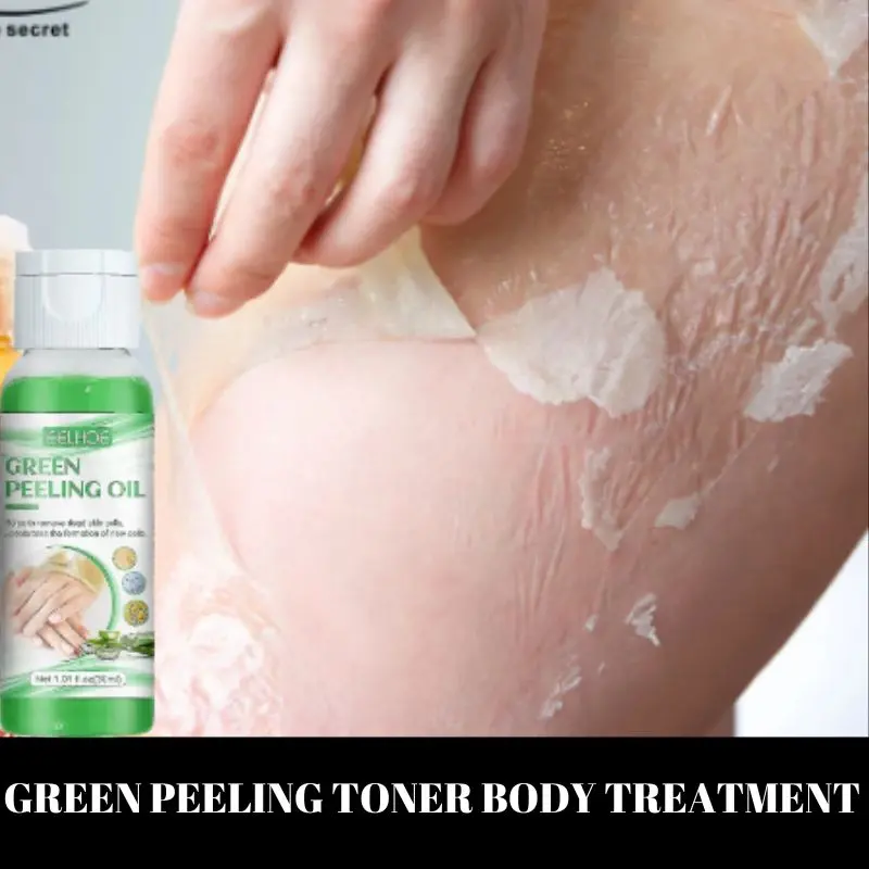 Eelhoe peeling toner perontok daki pencerah kulit