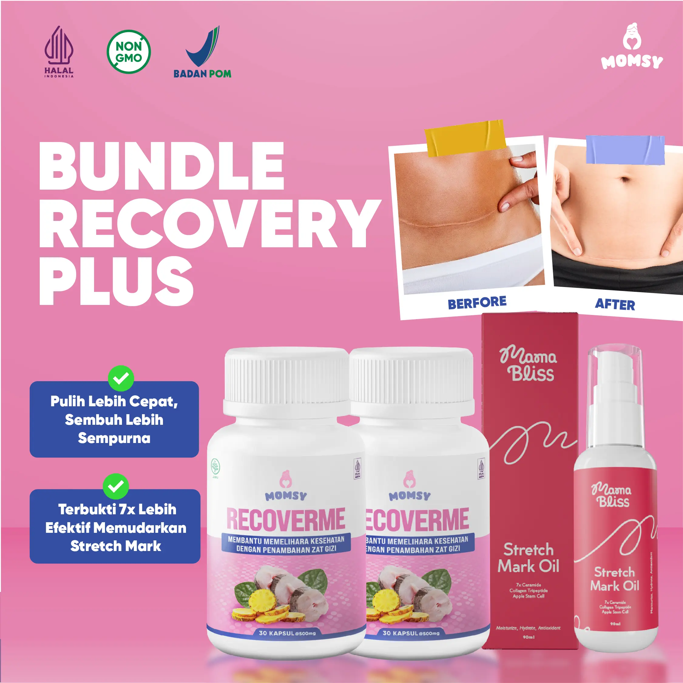 2 Recoverme + 1 MamaBliss Strecth Mark Oil 90ml