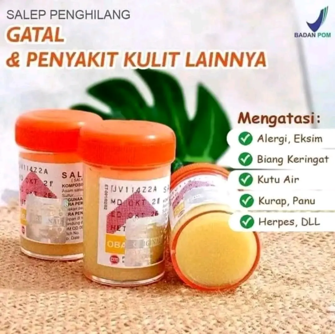 Paket 3 Pcs Zwafel Salep Sulfur untuk Meredakan Gatal-gatal dan Masalah Kulit Lainnya