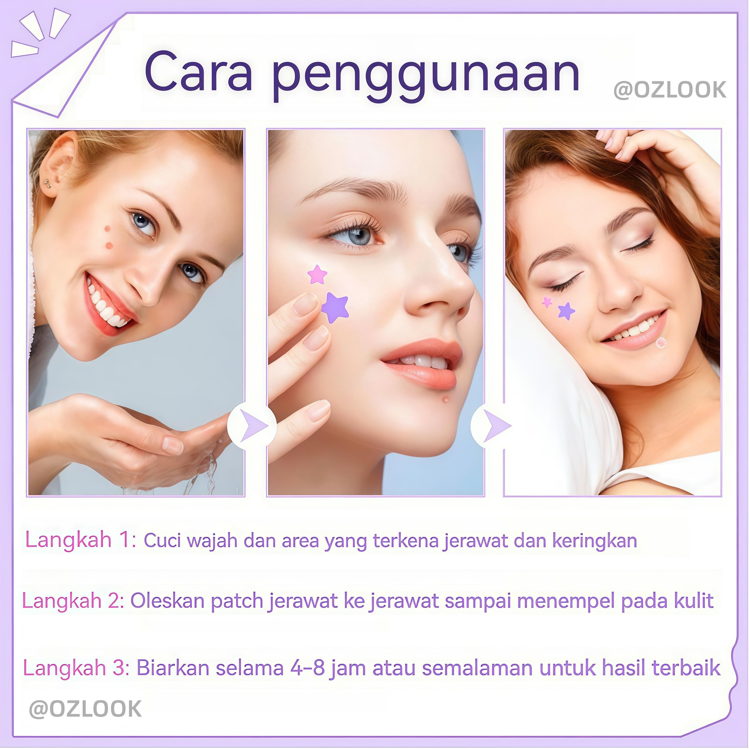 Jerawat Karakter Lucu Isi 160 Pcs Acne Pimple Patch Mengobati Mengangkat Isi Jerawat Dengan Desain Bintang Warna-warni
