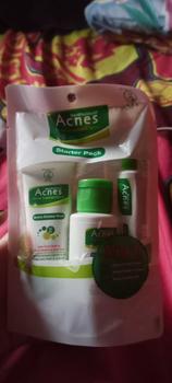 Product Review of NEW Acnes Starter Pack Acnes Treatment Series 3 Items from N**. 2