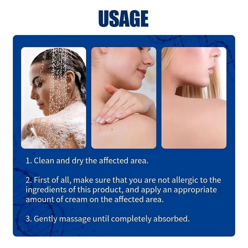 South Moon Salep Khusus Psoriasis - psoriasis ointment - Kurap Pada Kulit Kepala - Kutu Air - Kurap Pada Badan - Eksim - Infeksi Kulit - Obat Luar Mengatasi Gatal 20g Perawatan Tubuh Kering Pembersihan 8