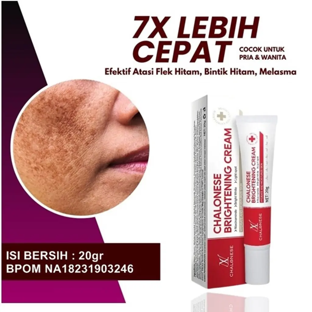Cream wajah pria penghilang flek hitam melasma pencerah wajah kusam BPOM