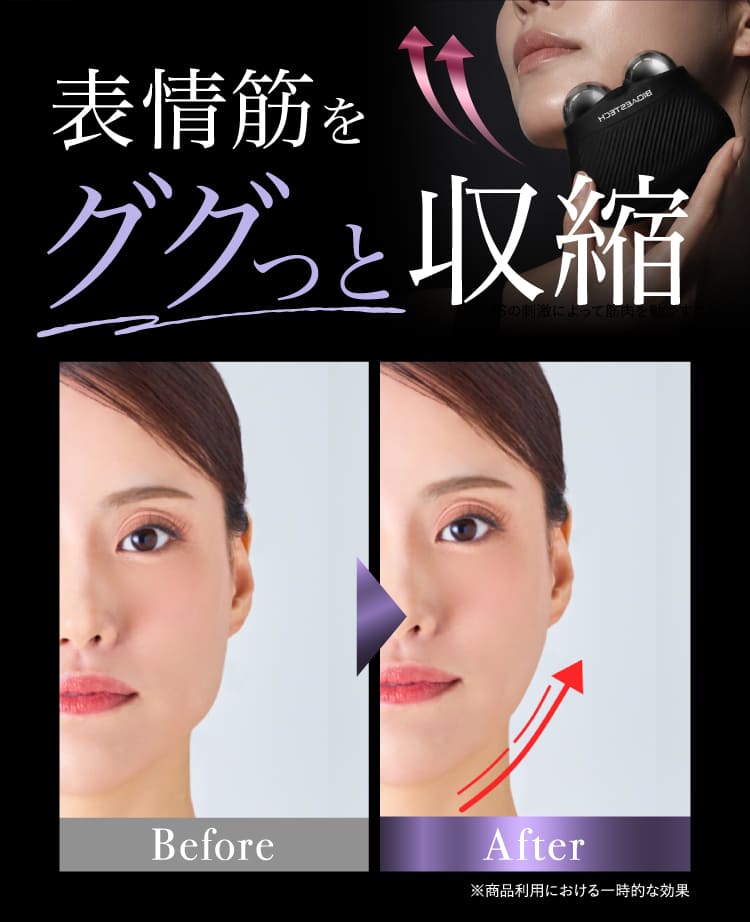Qoo10] BIOAESTECH 【公式】 バイオエステック 美顔器&専用